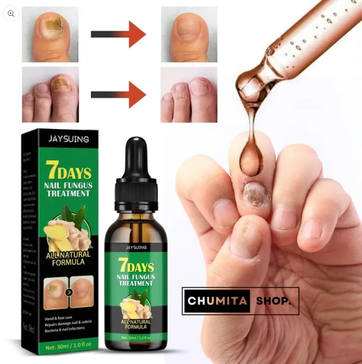 1+1 GRATIS | Biancat™ - Serum de crecimiento y reparación de uñas