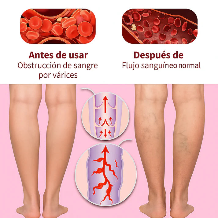 CREMA PARA VARICES - ALIVIO SEGURO - 2X1